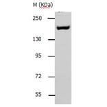 ACE1 Antibody from Signalway Antibody (31140) - Antibodies.com