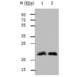 RHOB Antibody from Signalway Antibody (31144) - Antibodies.com