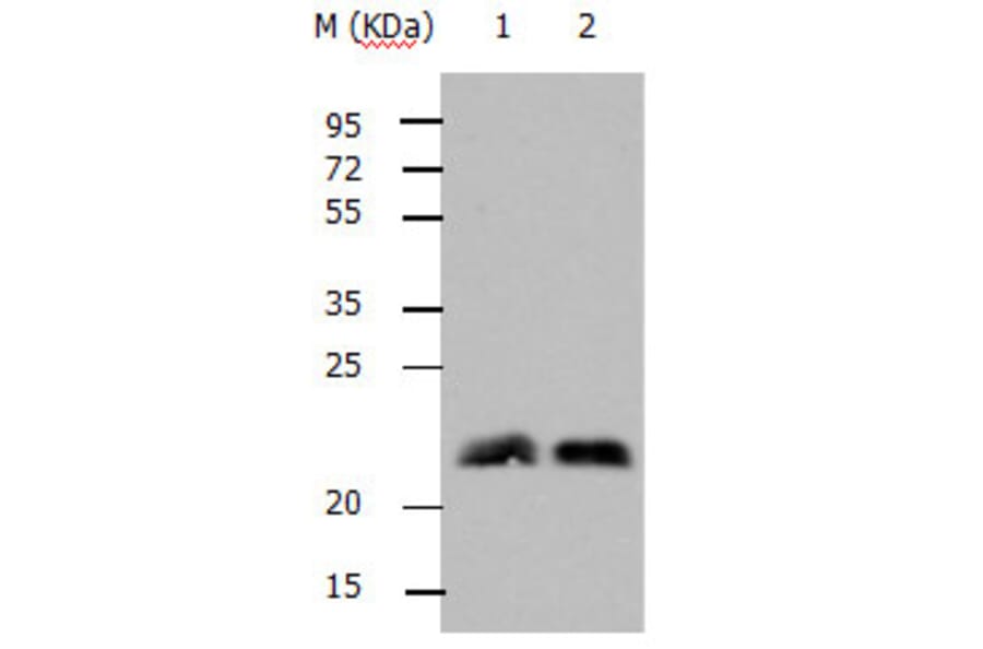 RHOB Antibody from Signalway Antibody (31144) - Antibodies.com