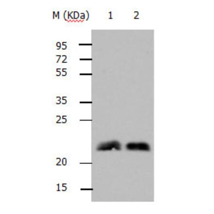 RHOB Antibody from Signalway Antibody (31144) - Antibodies.com