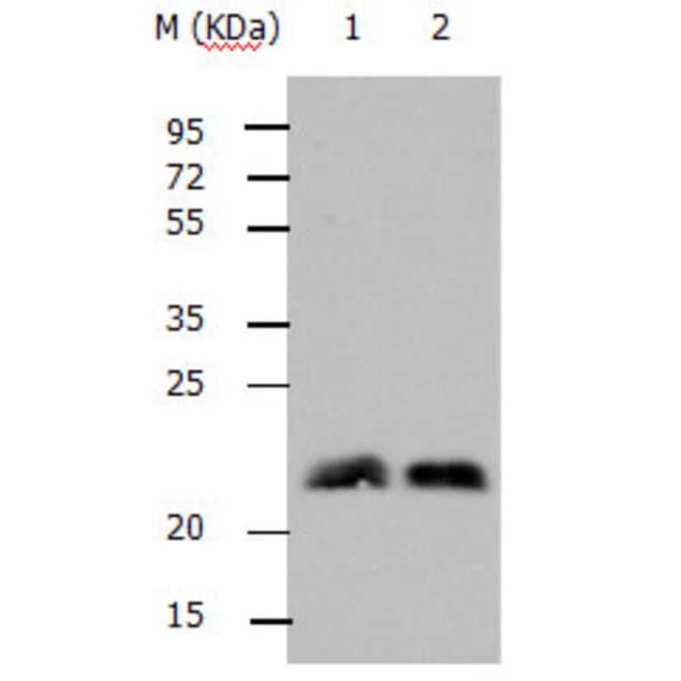 RHOB Antibody from Signalway Antibody (31144) - Antibodies.com