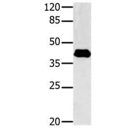 GNAZ Antibody from Signalway Antibody (31149) - Antibodies.com