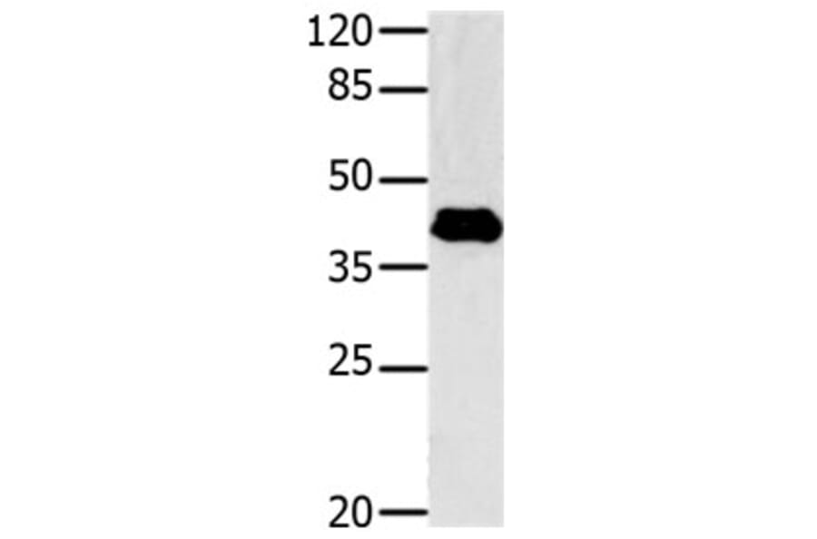 GNAZ Antibody from Signalway Antibody (31149) - Antibodies.com