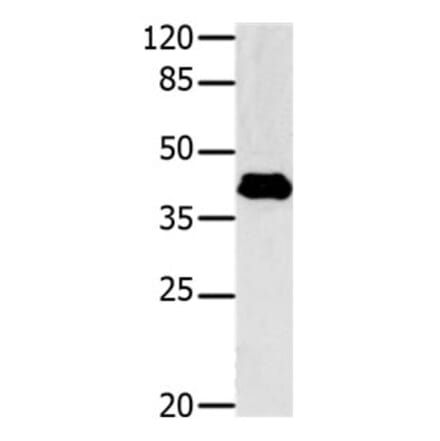 GNAZ Antibody from Signalway Antibody (31149) - Antibodies.com