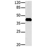 GNAZ Antibody from Signalway Antibody (31149) - Antibodies.com
