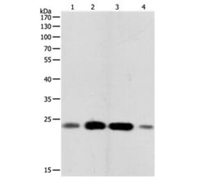 RHOA Antibody from Signalway Antibody (31150) - Antibodies.com