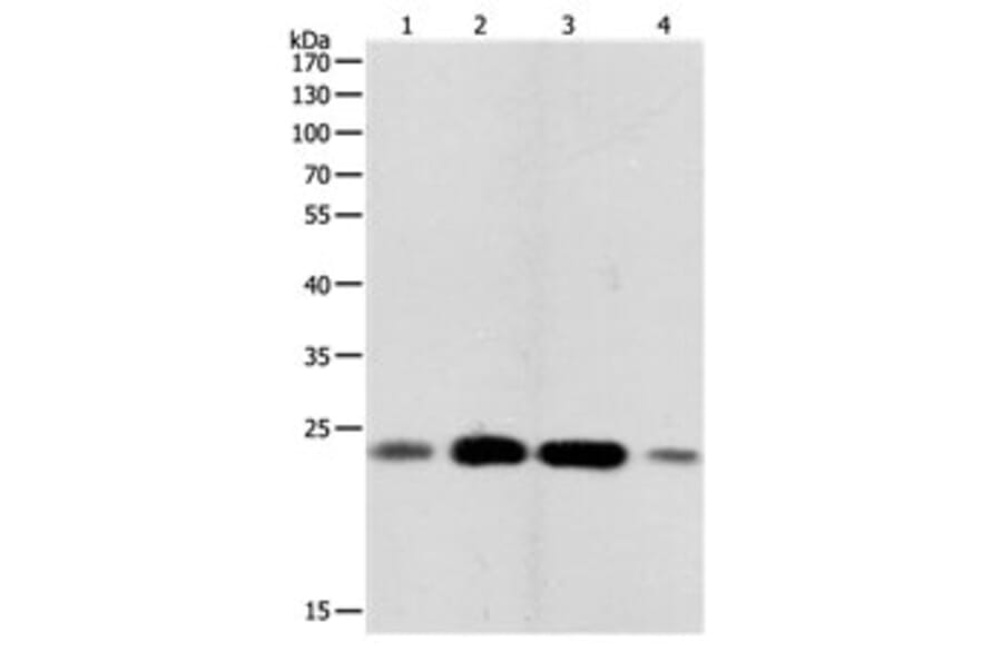 RHOA Antibody from Signalway Antibody (31150) - Antibodies.com