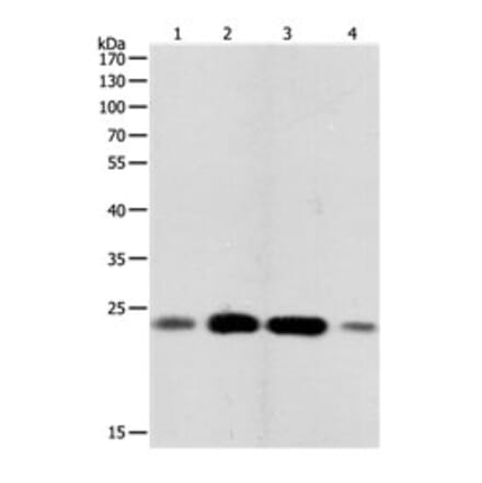 RHOA Antibody from Signalway Antibody (31150) - Antibodies.com