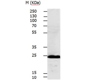 RALB Antibody from Signalway Antibody (31152) - Antibodies.com