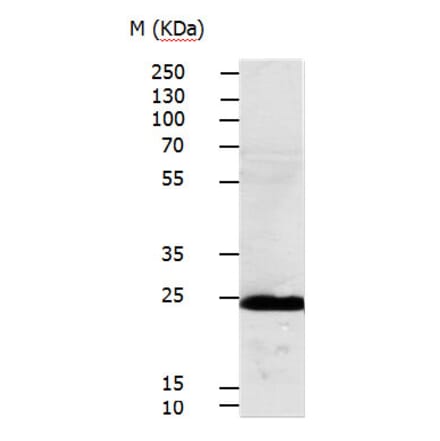 RALB Antibody from Signalway Antibody (31152) - Antibodies.com