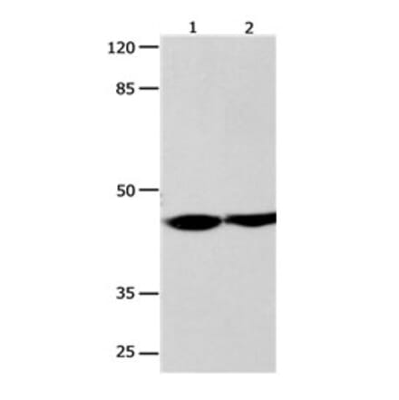 ALX4 Antibody from Signalway Antibody (31157) - Antibodies.com