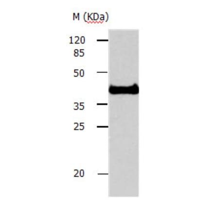 AVEN Antibody from Signalway Antibody (31160) - Antibodies.com