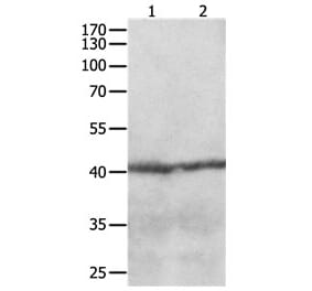 CCR8 Antibody from Signalway Antibody (31168) - Antibodies.com