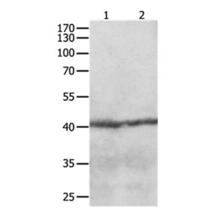CCR8 Antibody from Signalway Antibody (31168) - Antibodies.com