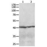 CCR8 Antibody from Signalway Antibody (31168) - Antibodies.com