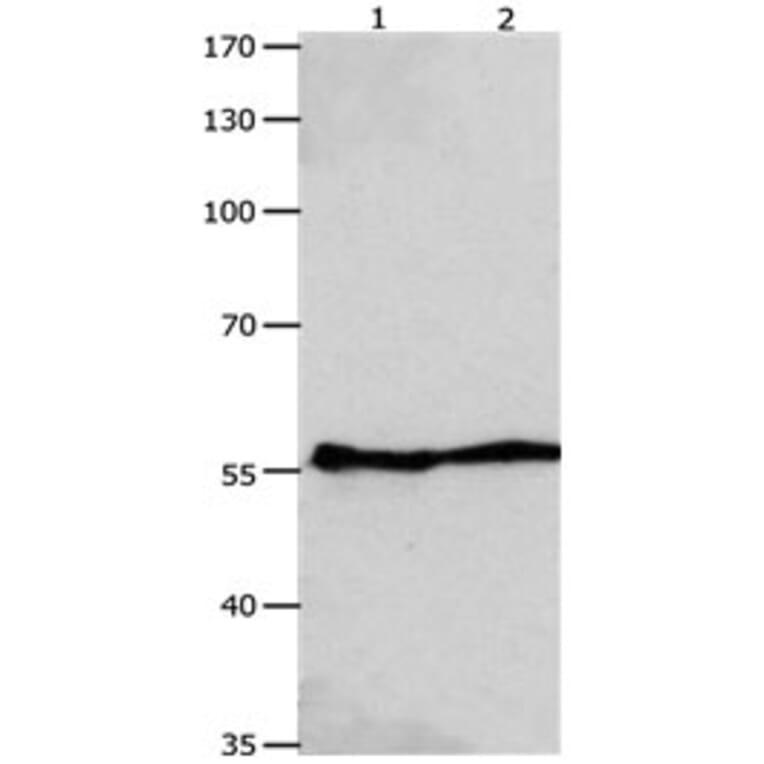 GJA9 Antibody from Signalway Antibody (31176) - Antibodies.com