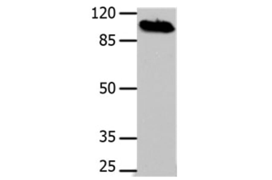 DNM1 Antibody from Signalway Antibody (31186) - Antibodies.com