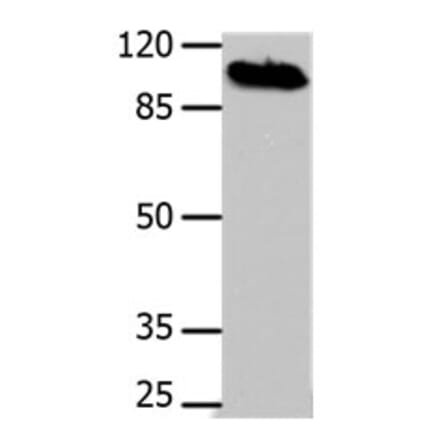 DNM1 Antibody from Signalway Antibody (31186) - Antibodies.com