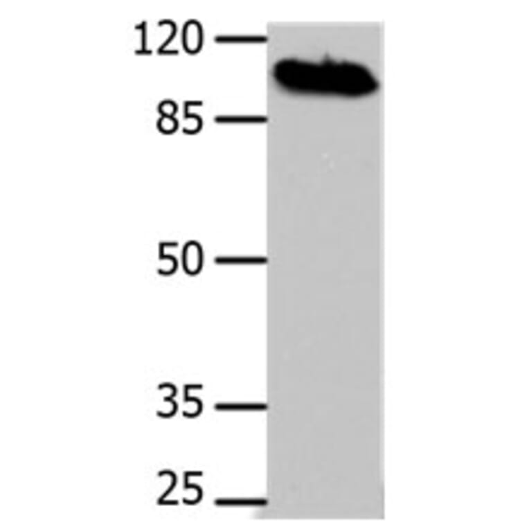 DNM1 Antibody from Signalway Antibody (31186) - Antibodies.com