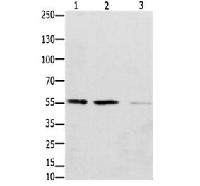 EPOR Antibody from Signalway Antibody (31195) - Antibodies.com