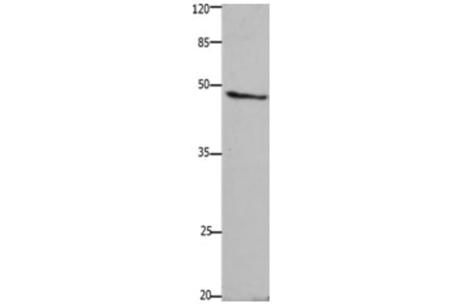 GHSR Antibody from Signalway Antibody (31208) - Antibodies.com