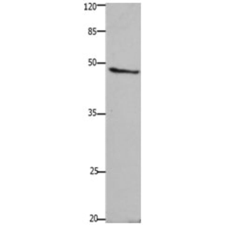 GHSR Antibody from Signalway Antibody (31208) - Antibodies.com