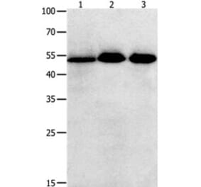 KLF5 Antibody from Signalway Antibody (31225) - Antibodies.com