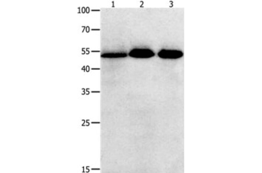 KLF5 Antibody from Signalway Antibody (31225) - Antibodies.com