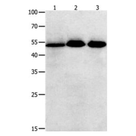 KLF5 Antibody from Signalway Antibody (31225) - Antibodies.com