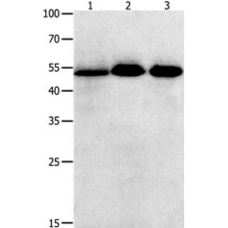 KLF5 Antibody from Signalway Antibody (31225) - Antibodies.com