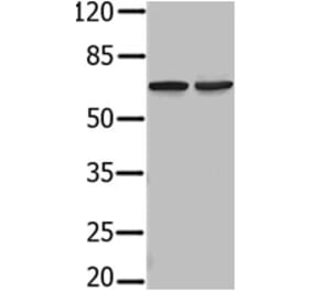 PIF1 Antibody from Signalway Antibody (31236) - Antibodies.com