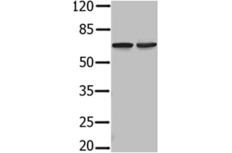 PIF1 Antibody from Signalway Antibody (31236) - Antibodies.com