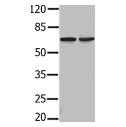 PIF1 Antibody from Signalway Antibody (31236) - Antibodies.com