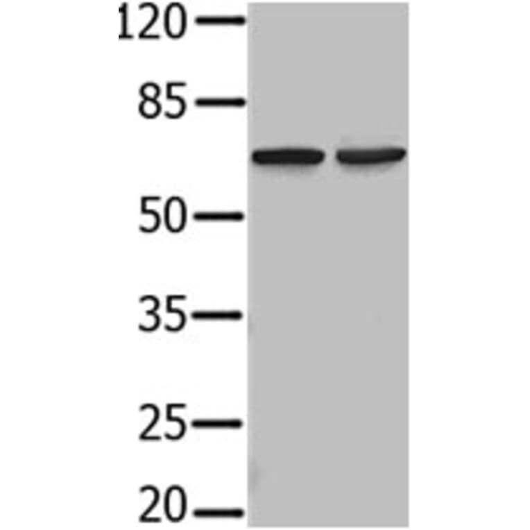 PIF1 Antibody from Signalway Antibody (31236) - Antibodies.com