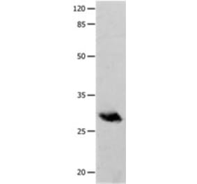 POMC Antibody from Signalway Antibody (31243) - Antibodies.com