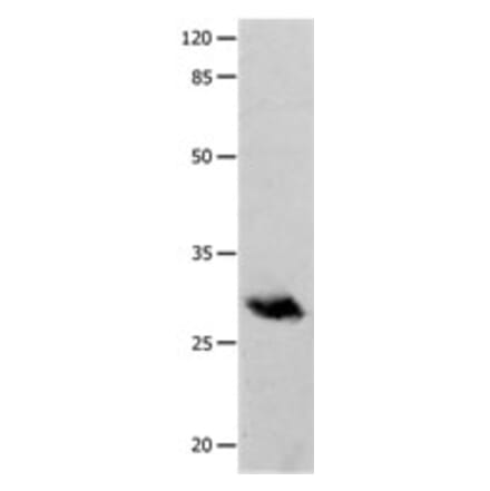 POMC Antibody from Signalway Antibody (31243) - Antibodies.com