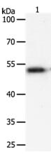 Gel: 10% SDS-PAGE Lane1: Human liver cancer tissue lysate Lysates: 40 µg per lane Primary antibody: 1/400 dilution Secondary antibody: Goat anti Rabbit IgG - H&L (HRP) at 1/10000 dilution Exposure time: 20 seconds