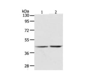 AGXT Antibody from Signalway Antibody (31276) - Antibodies.com