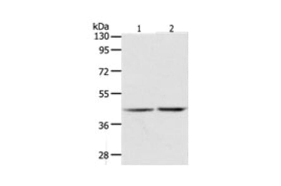 AGXT Antibody from Signalway Antibody (31276) - Antibodies.com