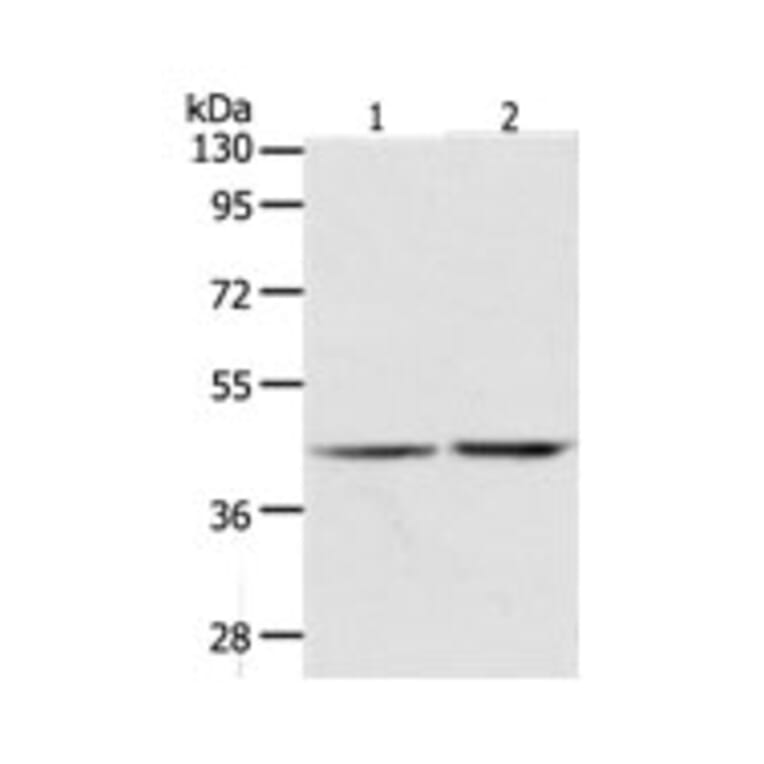 AGXT Antibody from Signalway Antibody (31276) - Antibodies.com