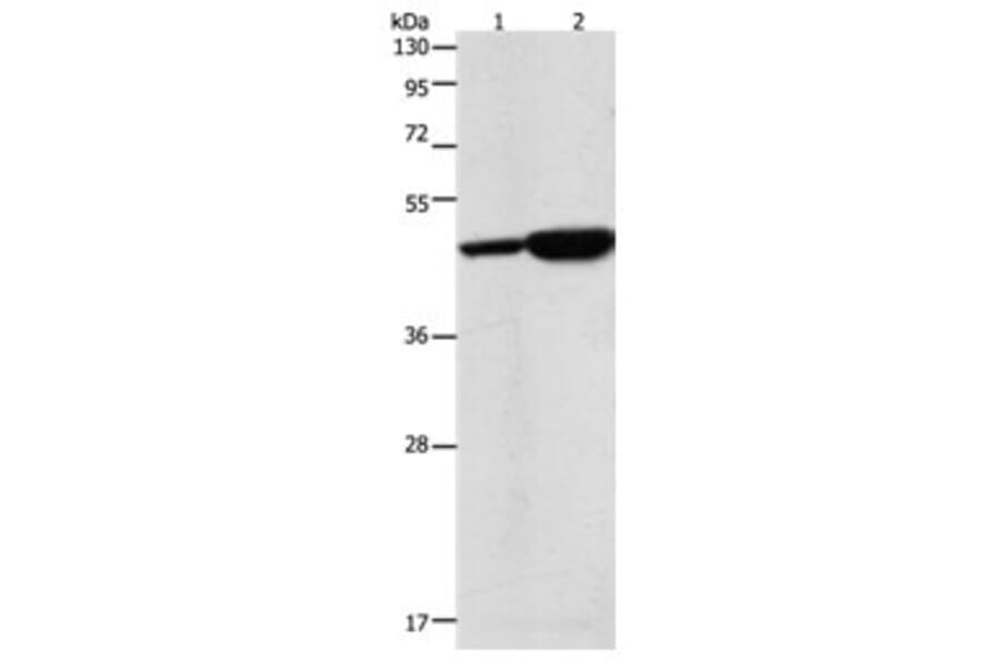 ENO2 Antibody from Signalway Antibody (31284) - Antibodies.com