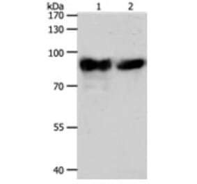 ACO2 Antibody from Signalway Antibody (31299) - Antibodies.com