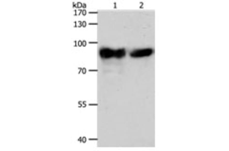 ACO2 Antibody from Signalway Antibody (31299) - Antibodies.com