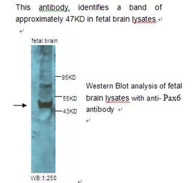 Pax6 Antibody from Signalway Antibody (39228) - Antibodies.com