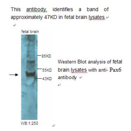 Pax6 Antibody from Signalway Antibody (39228) - Antibodies.com