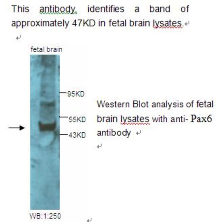 Pax6 Antibody from Signalway Antibody (39228) - Antibodies.com