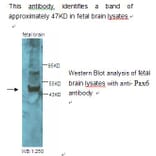 Pax6 Antibody from Signalway Antibody (39228) - Antibodies.com