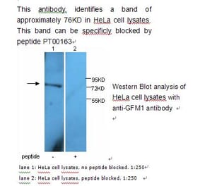 GFM1 Antibody from Signalway Antibody (39229) - Antibodies.com