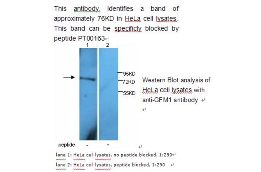 GFM1 Antibody from Signalway Antibody (39229) - Antibodies.com