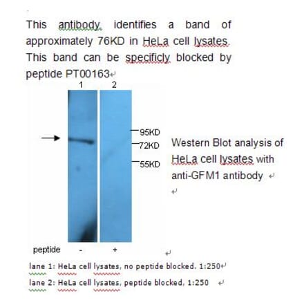 GFM1 Antibody from Signalway Antibody (39229) - Antibodies.com